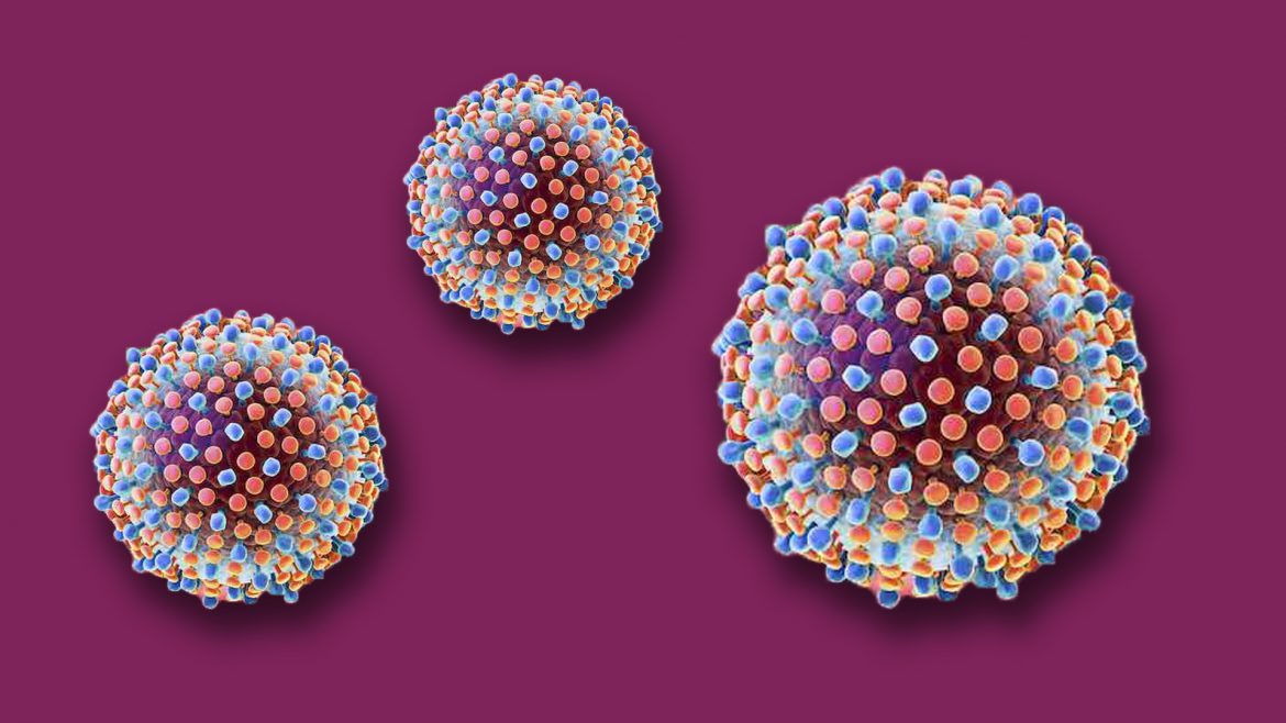hepatitis